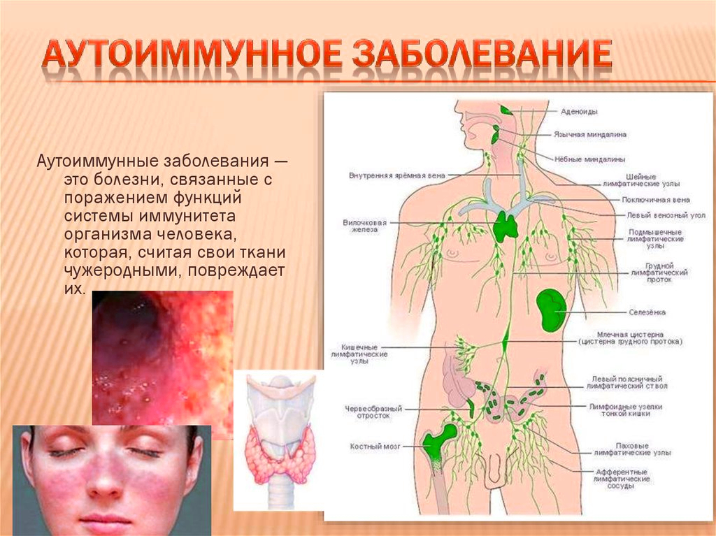 Заболевание организма. Болезнь всего организма. Смертельные болезни на букву б.